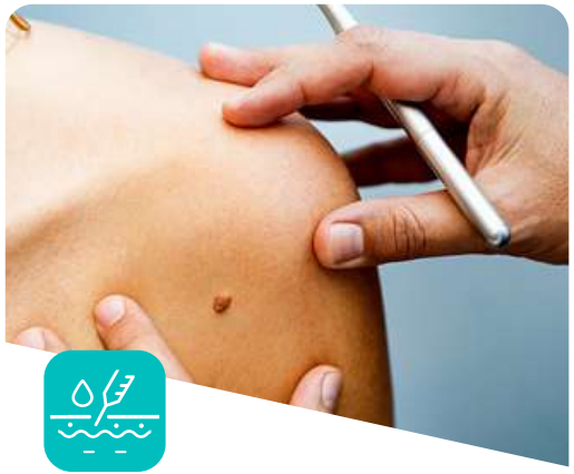 Cirugia dermatològica