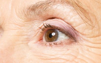 Prevenció d’arrugues causades per la contracció muscular