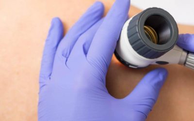 Tractaments làser per la teva pell